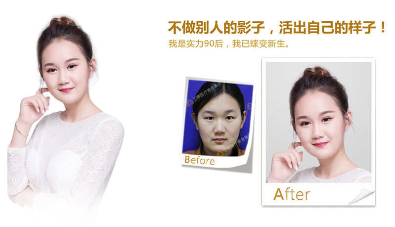 黔南纳米脂肪移植