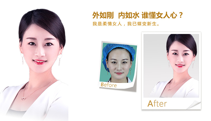 黔南V脸、线雕隆鼻